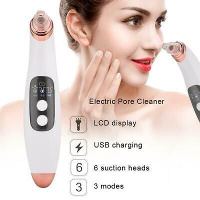 DermaSweep Pore Cleaner With 4 Interchangeable Suction Heads - Girly Goods Hub